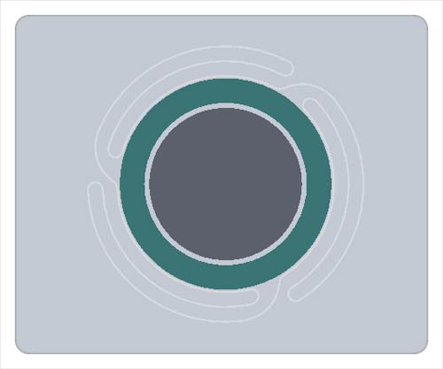 coronary stent