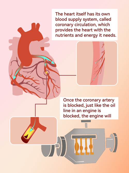 balloon catheter