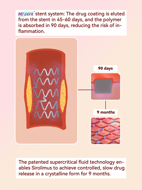 coronary stent system